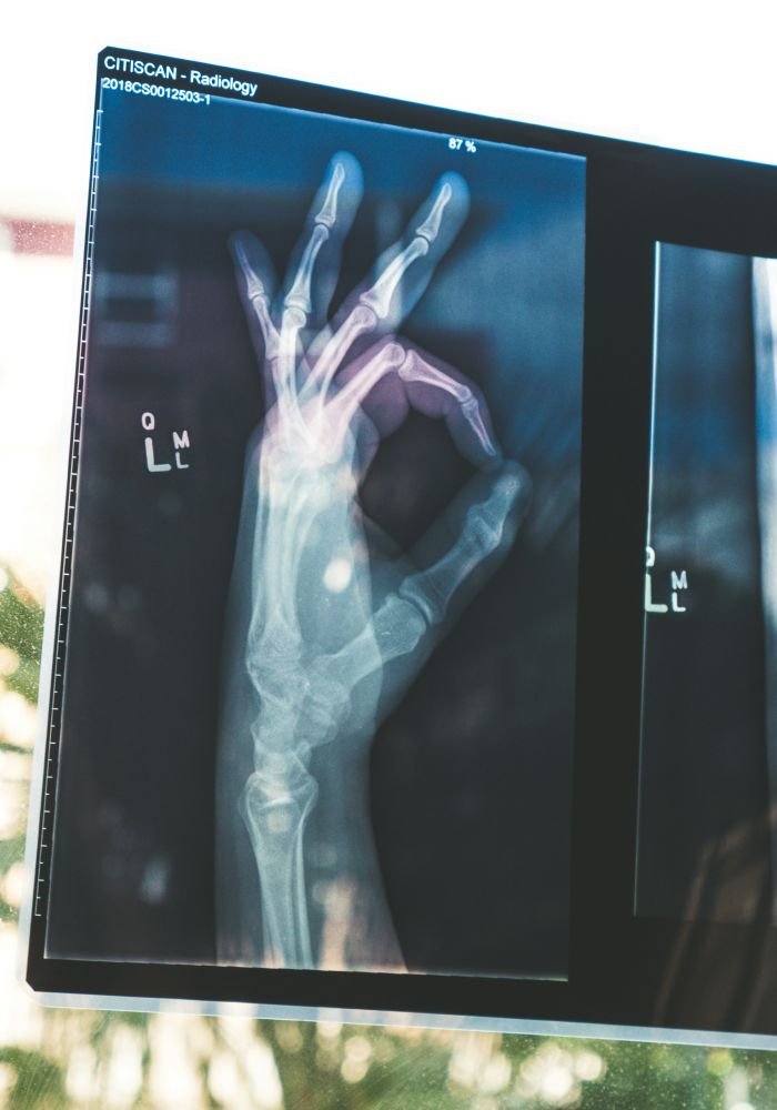 brandpilo